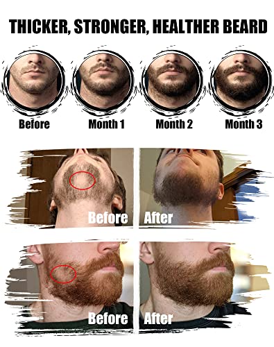 Komplet za rast brade-komplet za njegu brade s valjkom za bradu, uljem za rast brade, četkom za brijanje brade, sredstvom